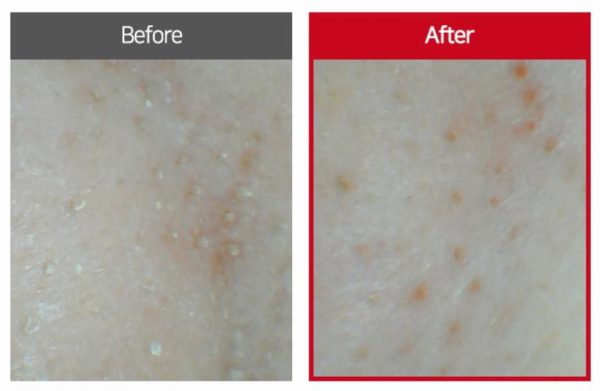 pH Balance Pure Cleansing Oil 150 ml - Görsel 3