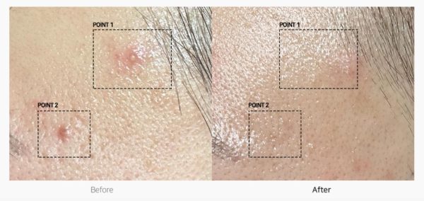 TC Spot Solution 32 ml - Görsel 2